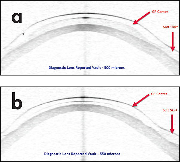 Contact Lens Spectrum PentaVision