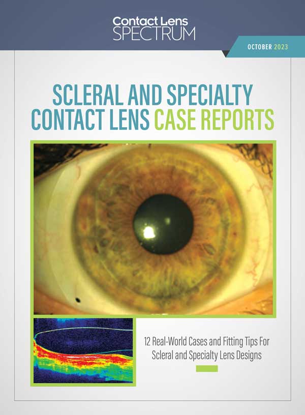Contact Lens Spectrum