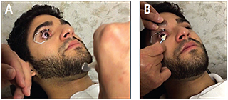 Contact Lens Spectrum | PentaVision
