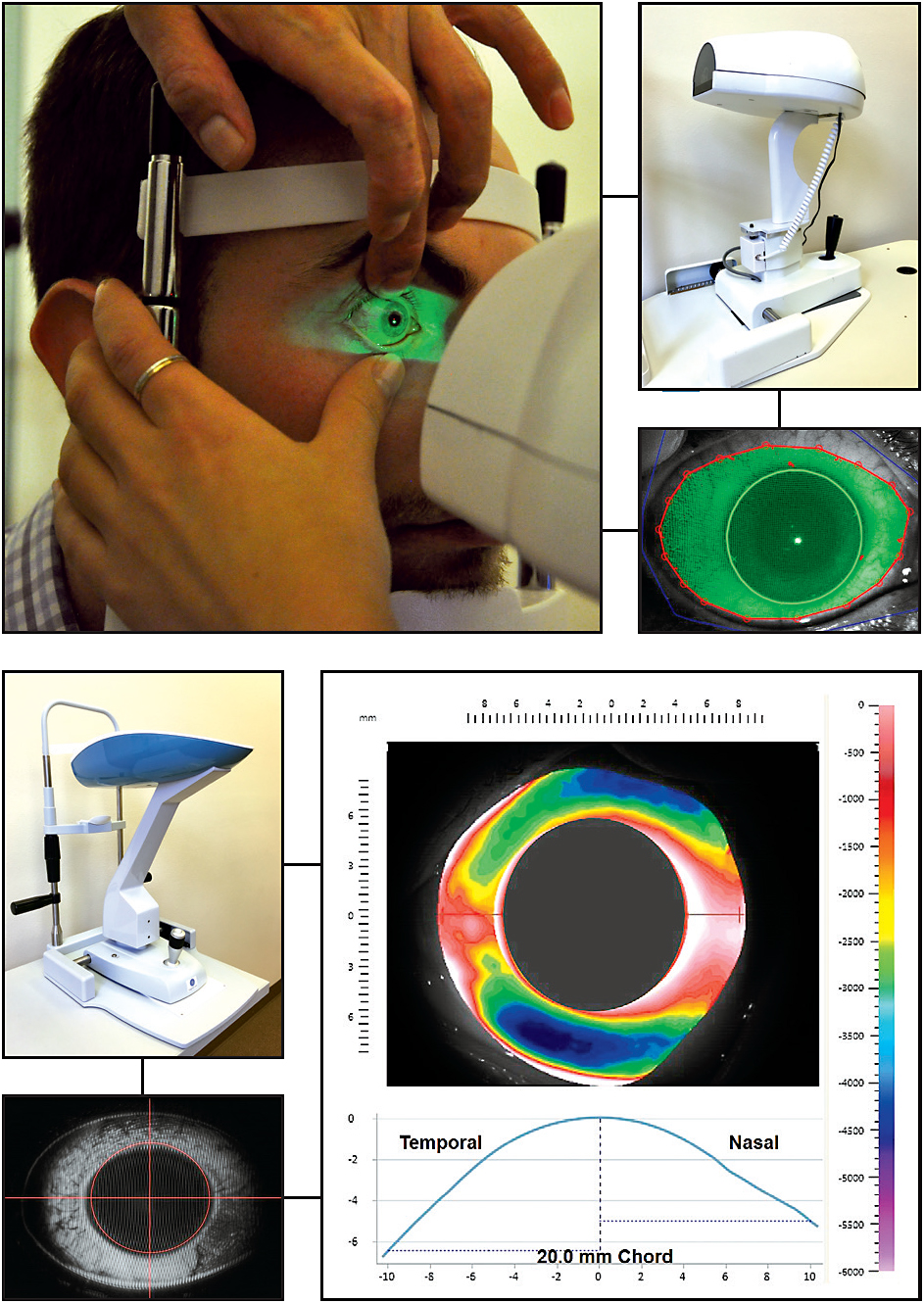 Contact Lens Spectrum PentaVision
