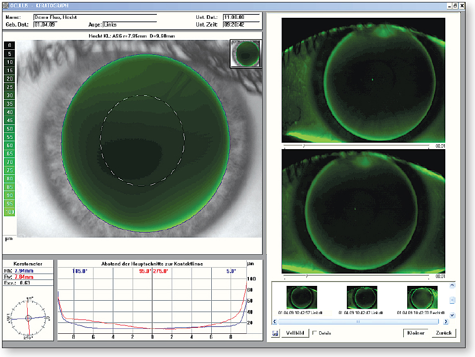 Contact Lens Spectrum PentaVision