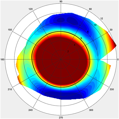 Contact Lens Spectrum PentaVision