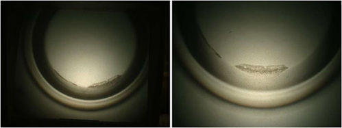 Figures 3 and 4. Scleral lens view at the contact lens projector after.