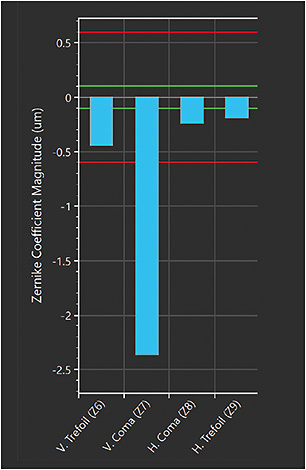 Figure 1. Aberrometry measurements OS.