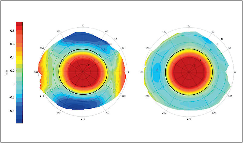 Contact Lens Spectrum PentaVision