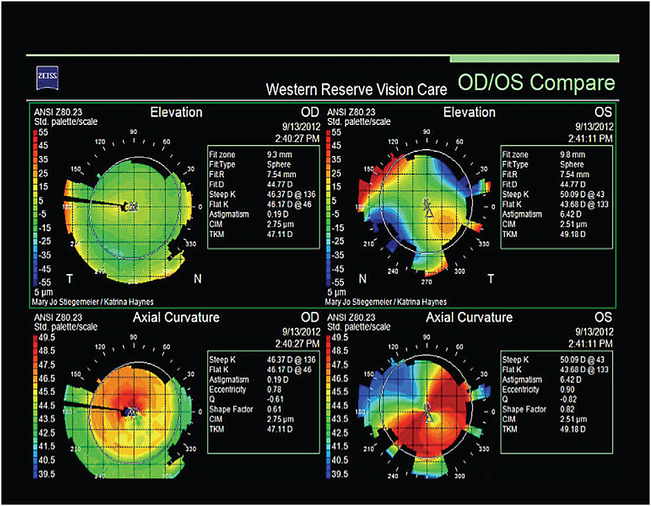 Contact Lens Spectrum PentaVision