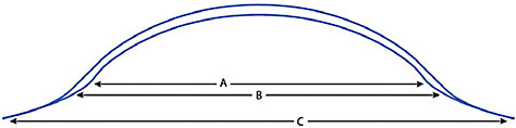 Figure 2. Anatomy of a scleral lens. A: Optical zone, B: Transition zone, C: Landing zone (Michaud et al, 2020).