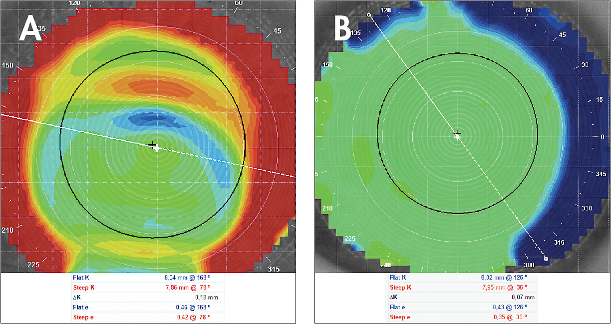 Contact Lens Spectrum PentaVision