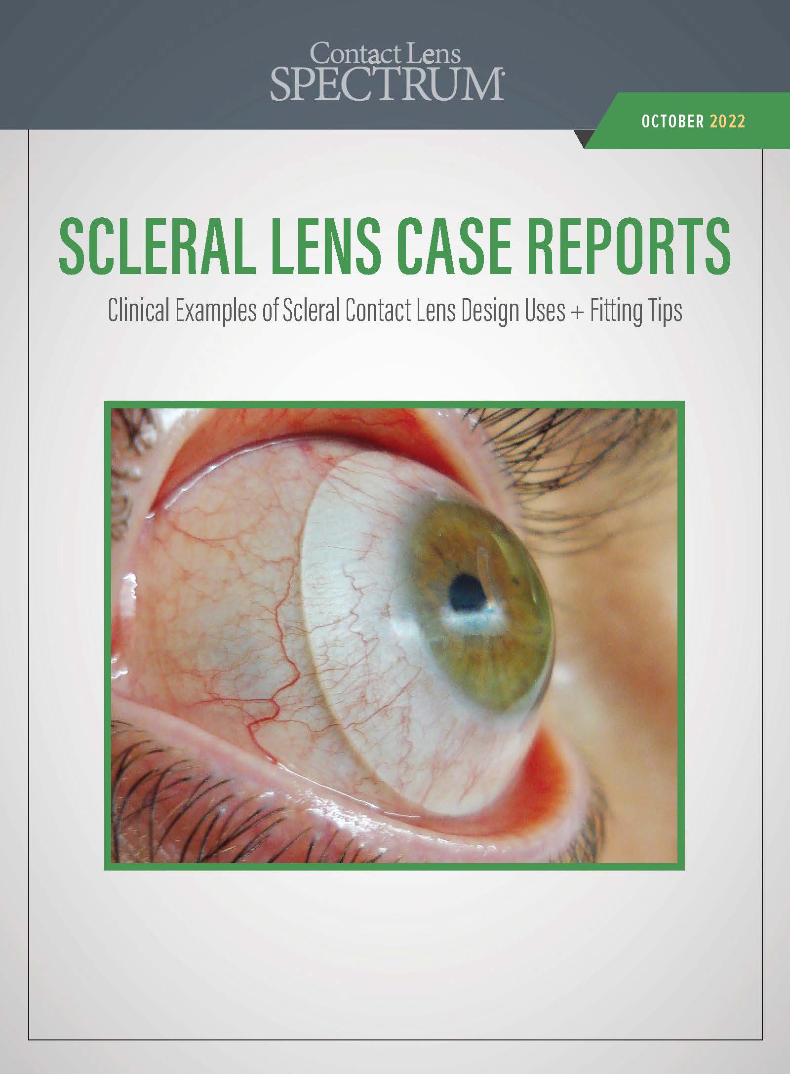 Contact Lens Spectrum PentaVision